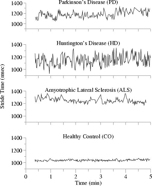 Gait Dynamics in NeuroDegenerative Disease Data Base
