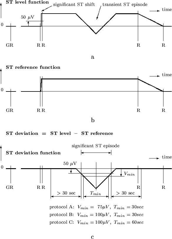 \begin{figure}\ \\
{\centering\epsfig{file=figure2.ps}}\\
\ \\
\end{figure}