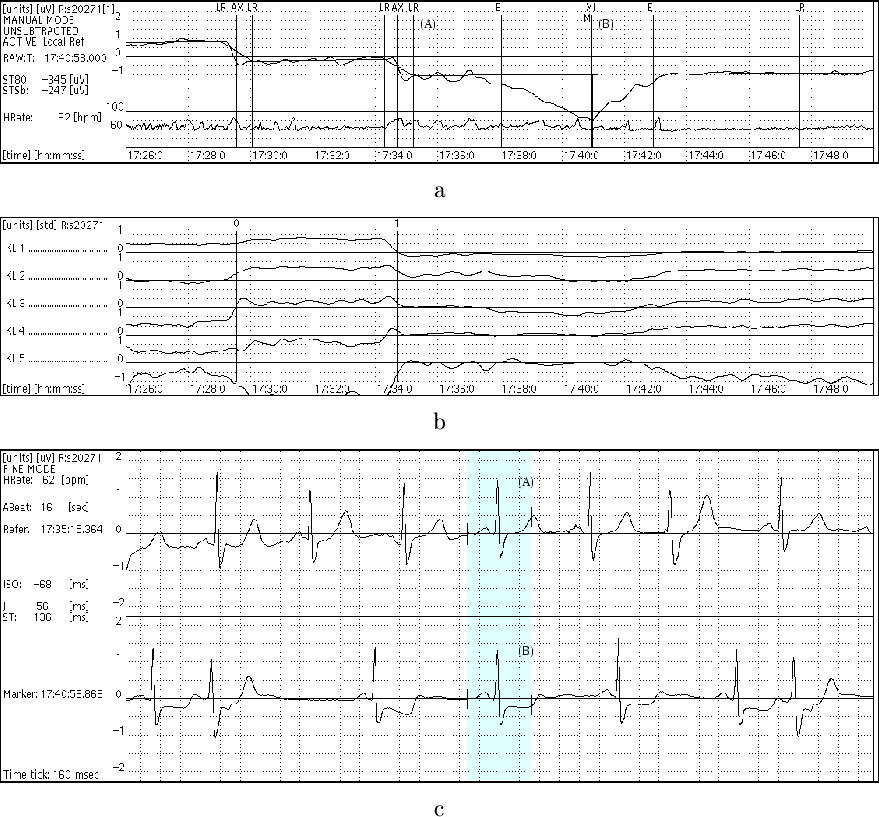 \begin{figure}\ \\
{\centering\epsfig{file=figure3.ps}}\\
\ \\
\end{figure}