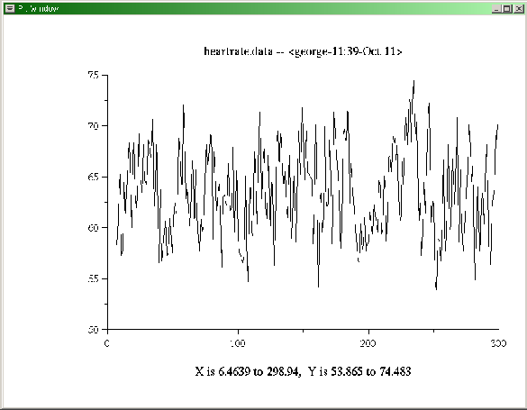 \begin{figure}\begin{center}
\epsfig{file=simple0,height=8cm}\end{center}\end{figure}
