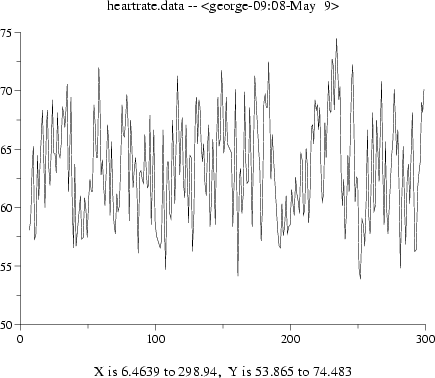 \begin{figure}\begin{center}
\epsfig{file=simple1,height=8cm}\end{center}\end{figure}