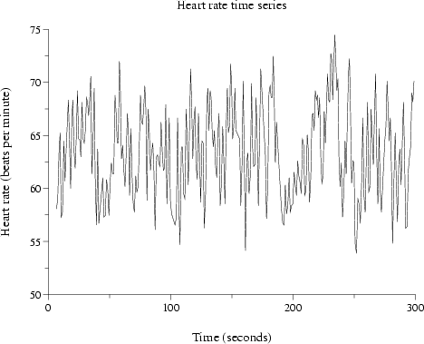 \begin{figure}\begin{center}
\epsfig{file=simple2,height=8cm}\end{center}\end{figure}