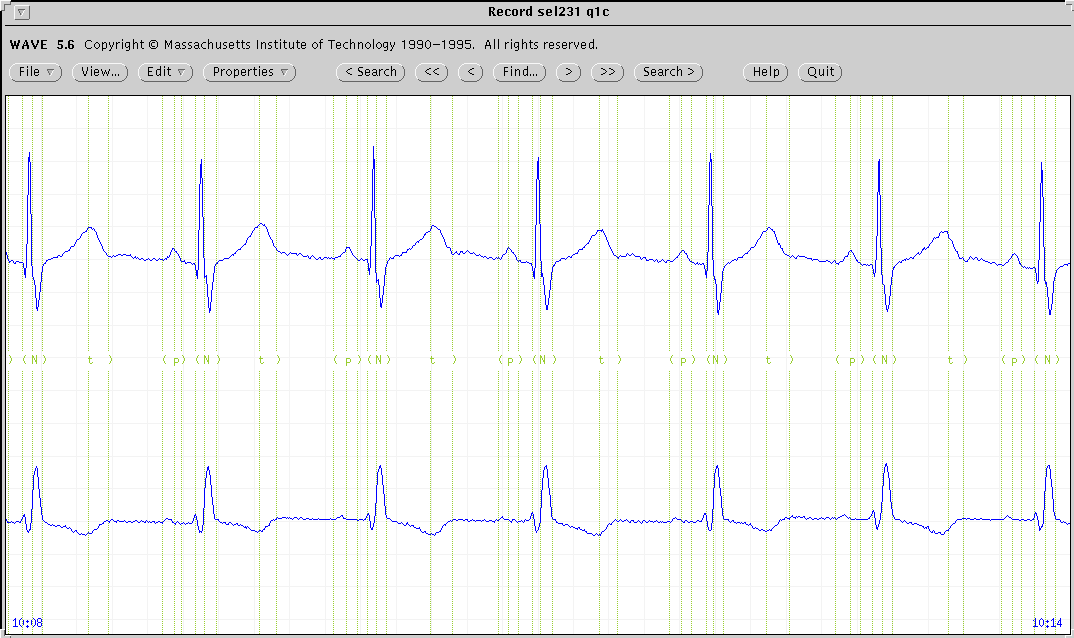 \begin{figure*}
{\centering\epsfig{file=ecg2.eps,width=\linewidth}}
\end{figure*}