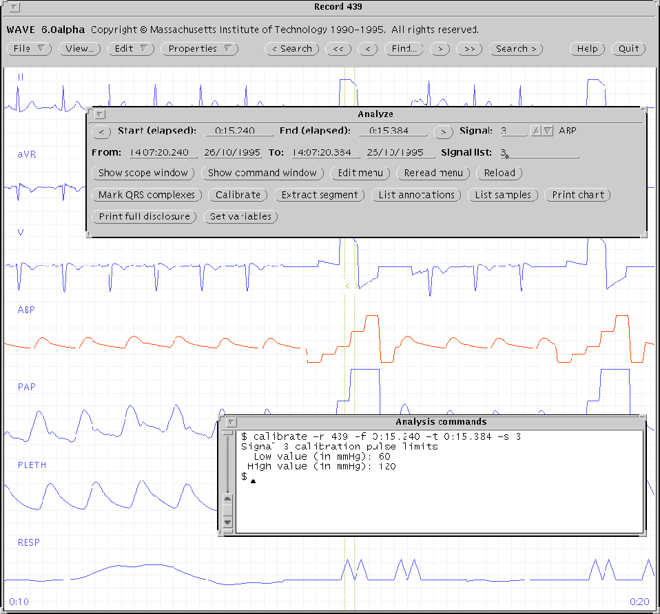 \begin{figure}\centerline{\epsfig{file=calibrate}}\index{calibration}
\index{analysis commands window@{\sf Analysis Commands} window}
\end{figure}