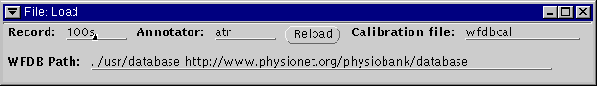 \begin{figure}\centerline{\epsfig{file=load-window}}
\end{figure}