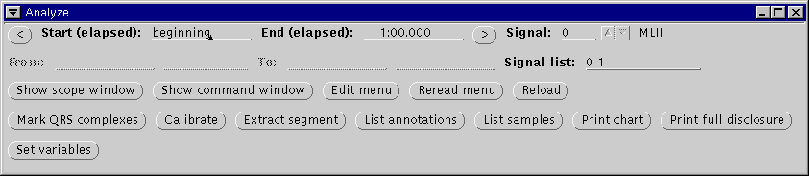 \begin{figure}\centerline{\epsfig{file=analyze-window}}
\end{figure}