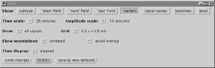 \begin{figure}\centerline{\epsfig{file=view-window}}
\end{figure}