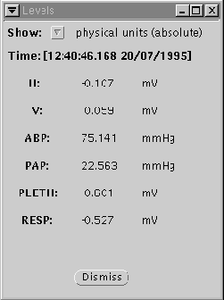 \begin{figure}\centerline{\epsfig{file=level-window}}
\end{figure}