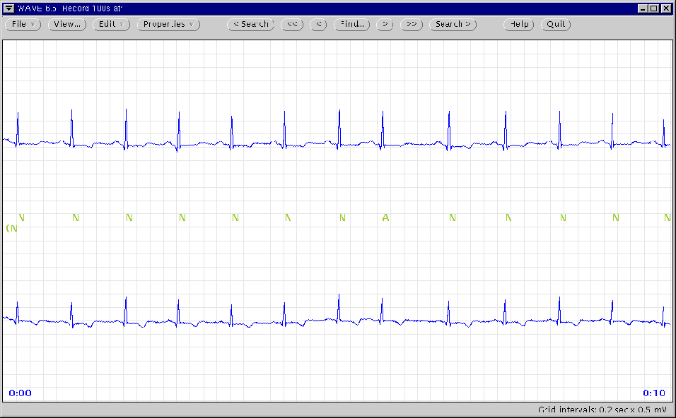 \begin{figure}\centerline{\epsfig{file=main-window}}\index{main window}
\end{figure}