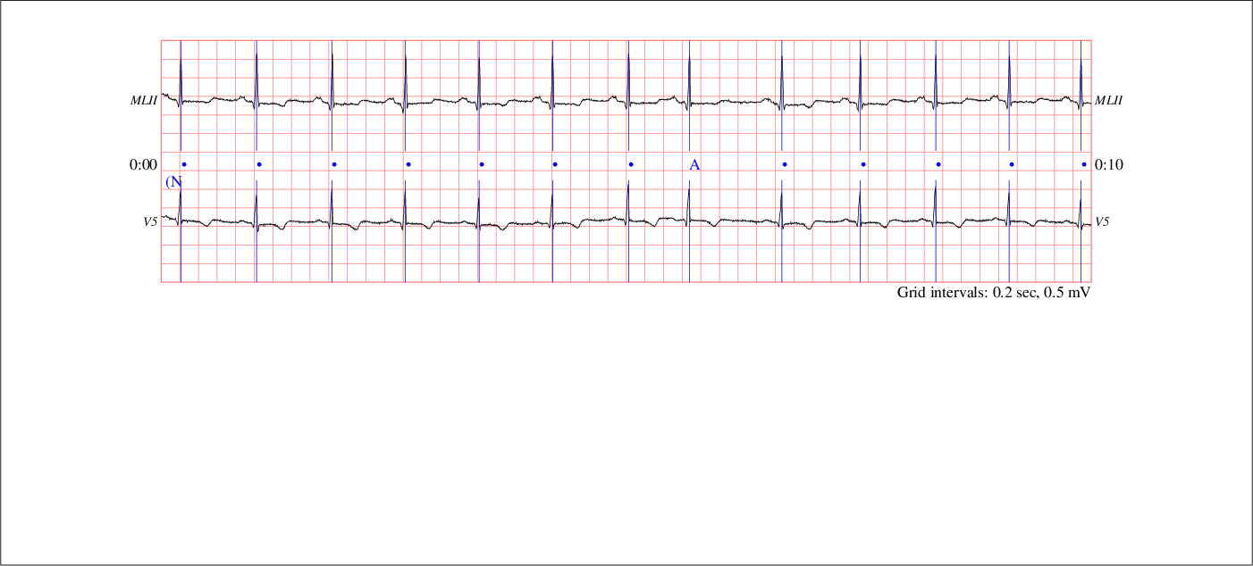 \begin{figure}\fbox{\centerline{\epsfig{file=chart1,width=.9\linewidth}}}
\end{figure}