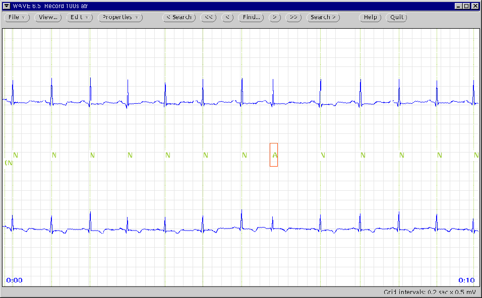 \begin{figure}\centerline{\epsfig{file=main-with-markers}}\index{selection rectangle}
\index{marker bars}
\end{figure}