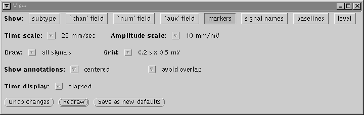 \begin{figure}\centerline{\epsfig{file=view-window}}\index{View window@{\sf View} window}
\end{figure}