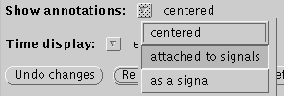 \begin{wrapfigure}{l}{6cm}
\mbox{\epsfig{file=attach-to-signals}}
\end{wrapfigure}