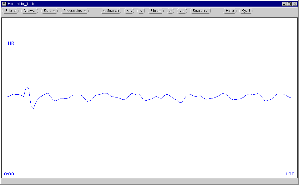 \begin{figure}\centerline{\epsfig{file=main-with-hr}}\end{figure}